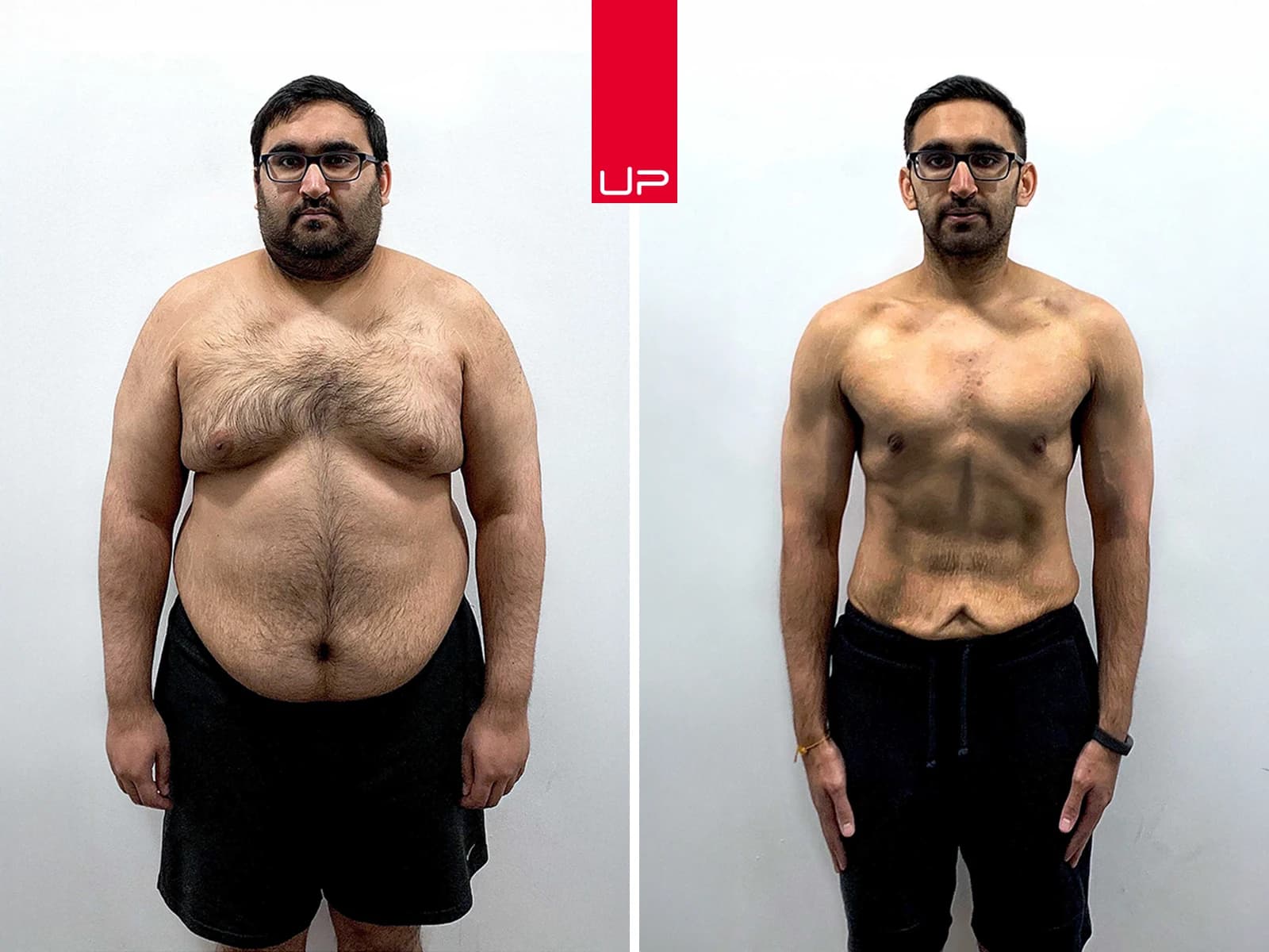 Before-and-after weight loss result from a Reta1 member (photo 3)